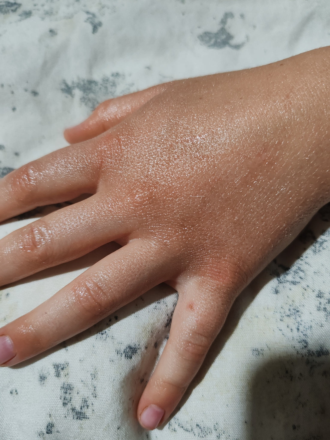 Skin after using the product